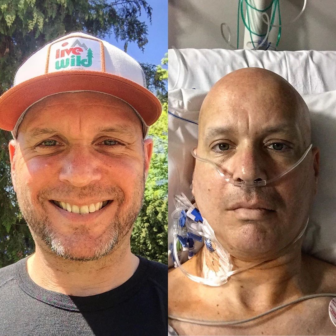 Miles Beyond Remission - the story of Jonathan Acott